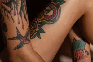 Borttagning av tatuering