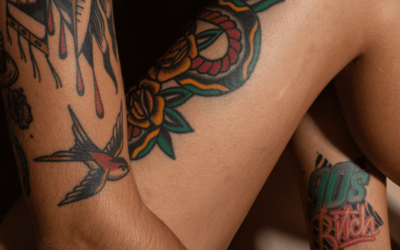 Risker med borttagning av tatuering