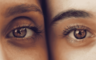 Dermapen under ögonen: En omfattande guide